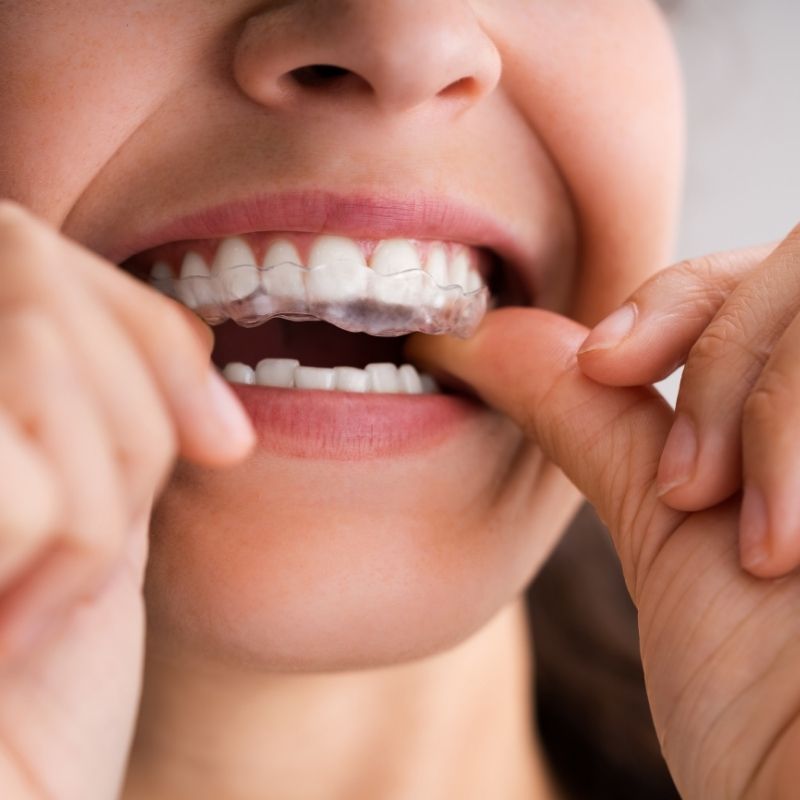 Expertise Dental Airway Health Night Guards & Oral Appliances