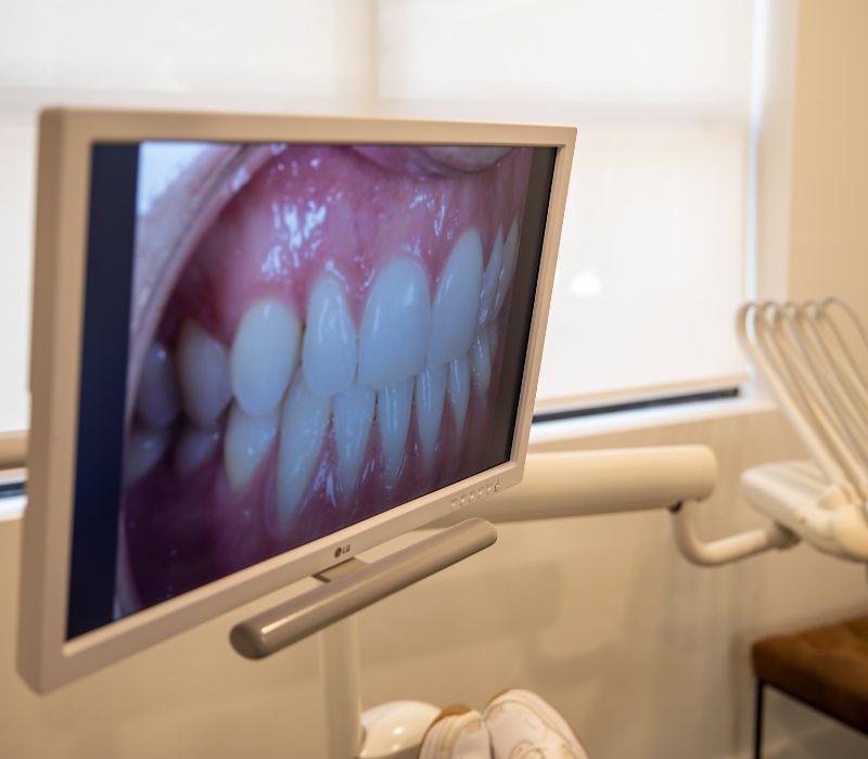 Be Proud of your Smile again WITH A FULL MOUTH REHABILITATION