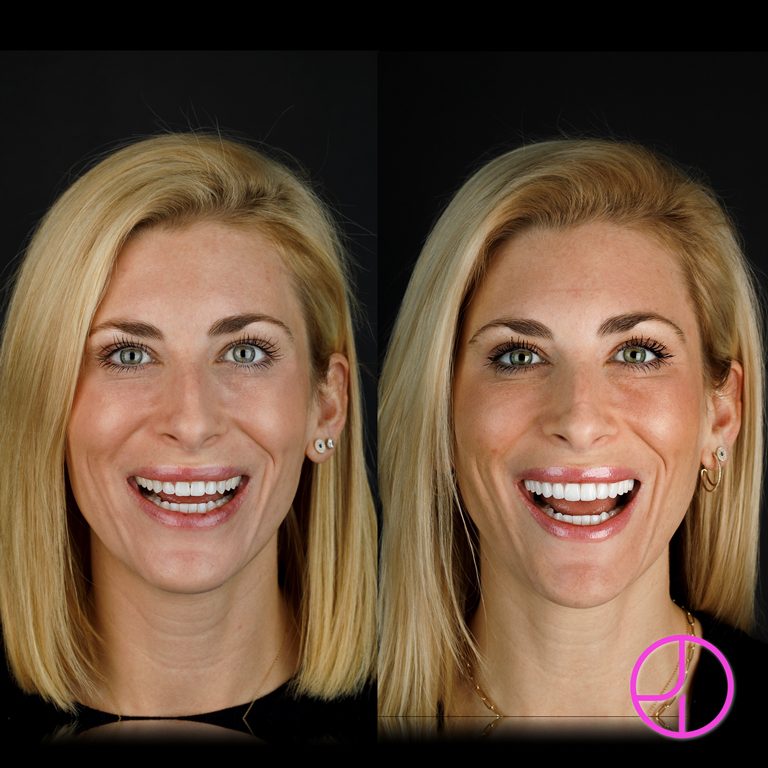 Expertise Dental Smile Gallery