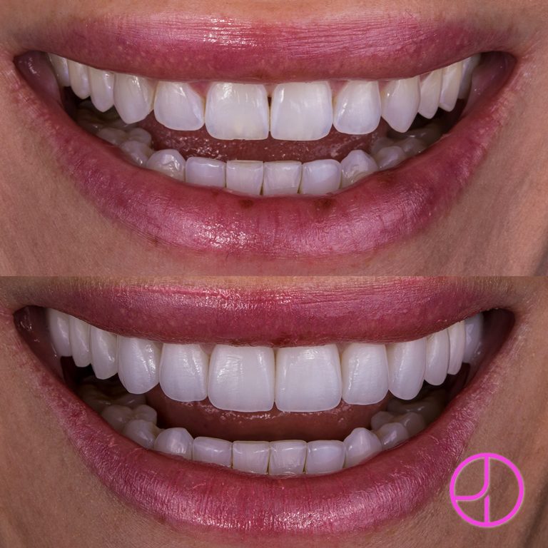 Expertise Dental Smile Gallery