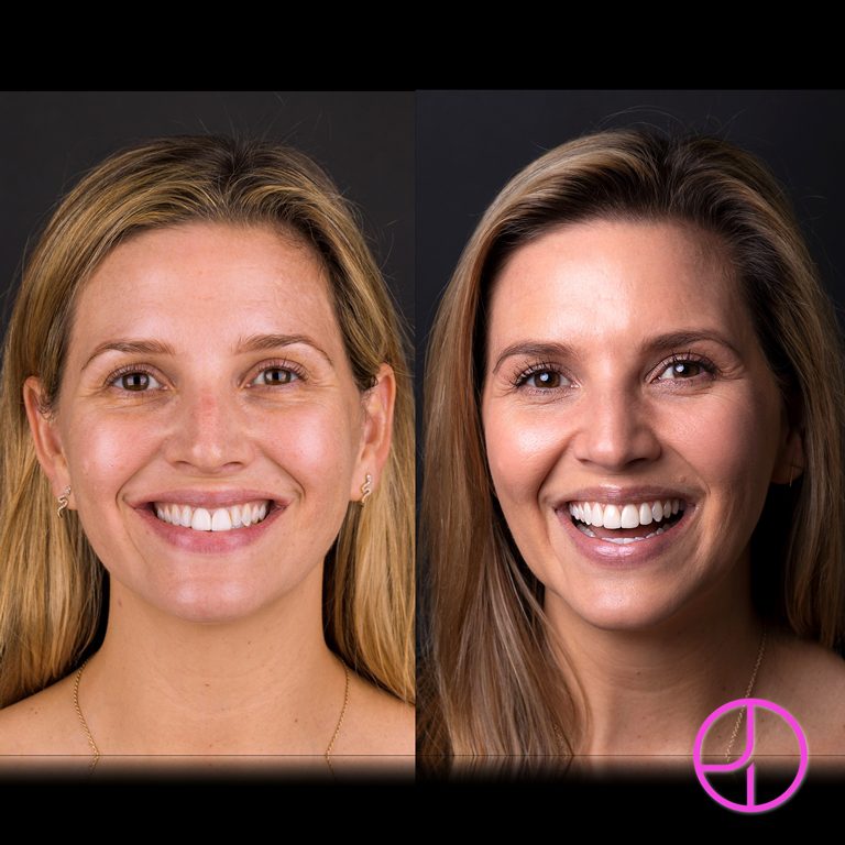 Expertise Dental Smile Gallery