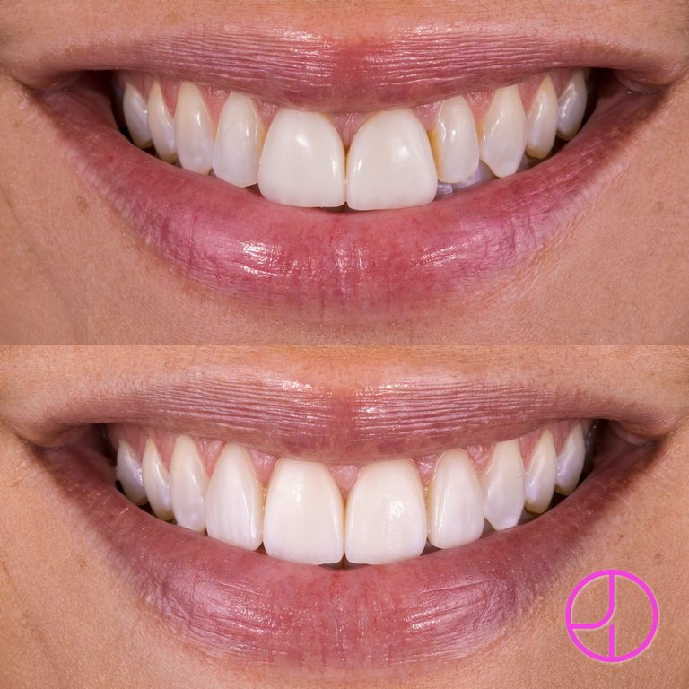 Expertise Dental Smile Gallery