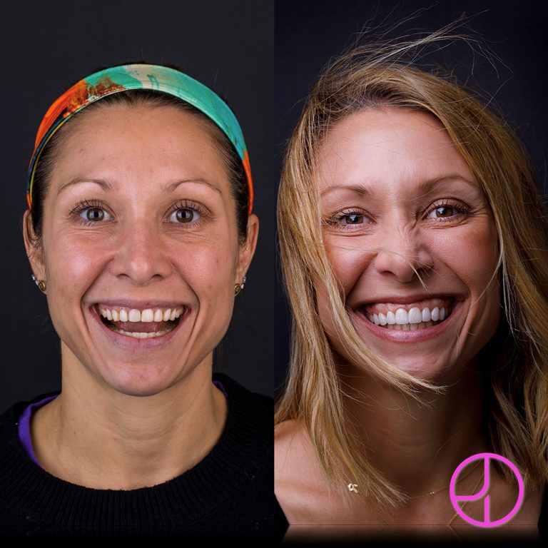Expertise Dental Smile Gallery