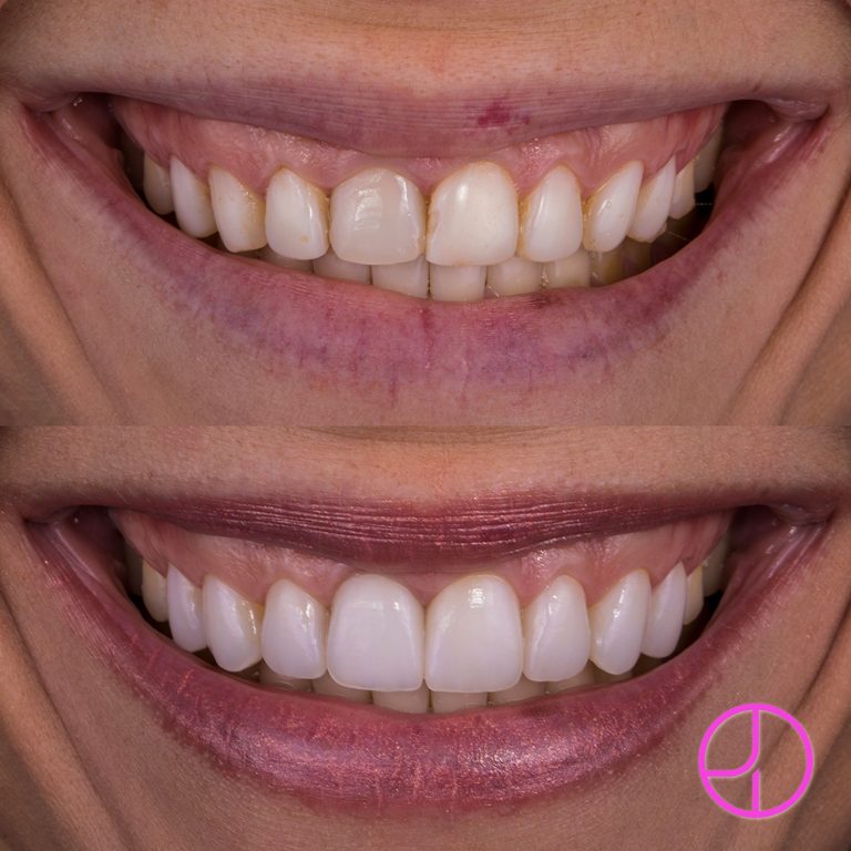 Expertise Dental Smile Gallery