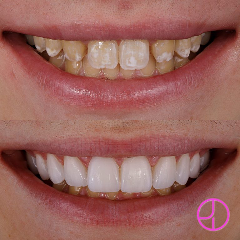 Expertise Dental Smile Gallery