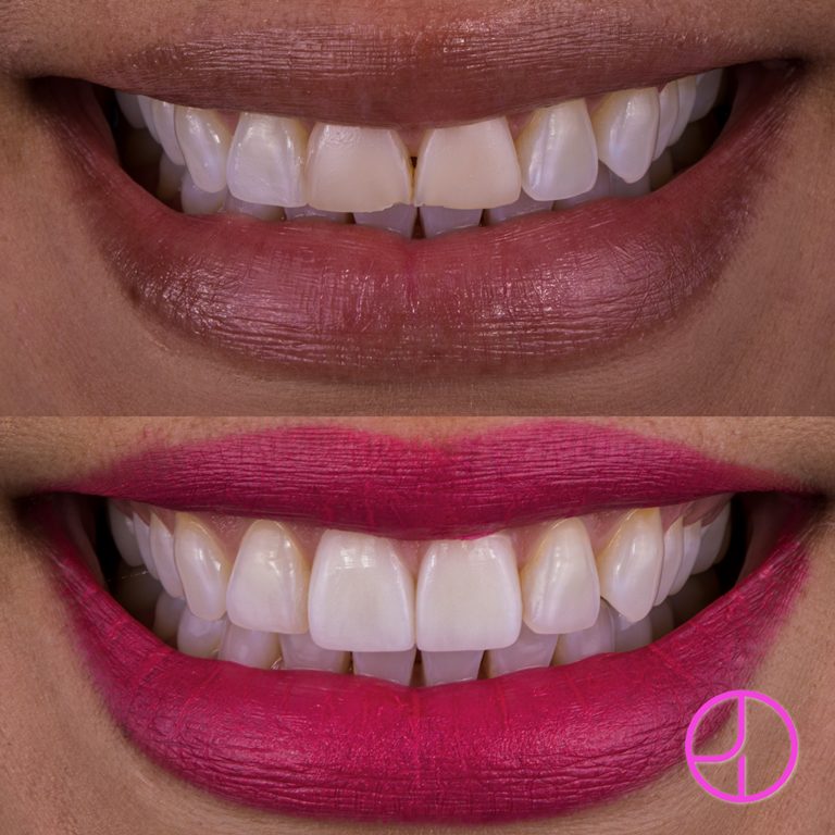 Expertise Dental Smile Gallery
