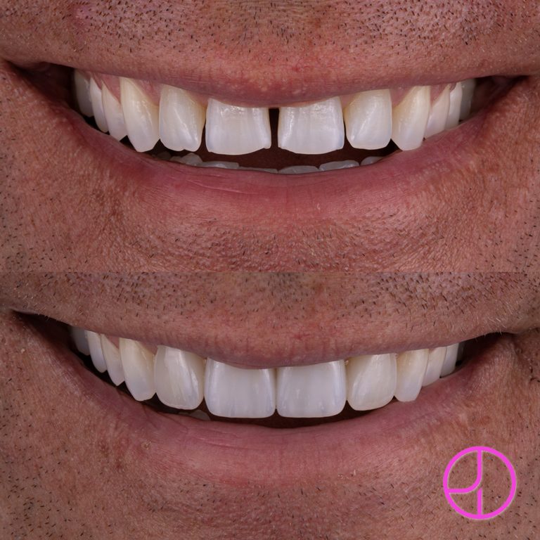 Expertise Dental Smile Gallery