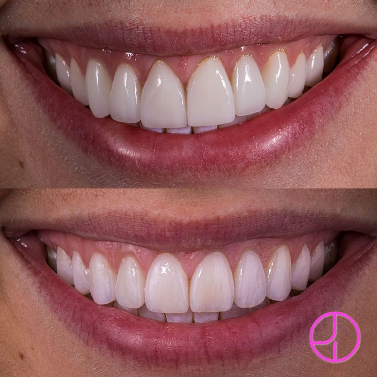 Expertise Dental Smile Gallery