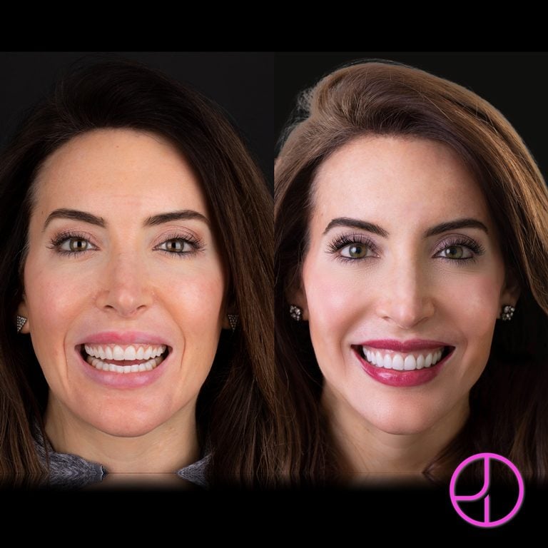Expertise Dental Smile Gallery