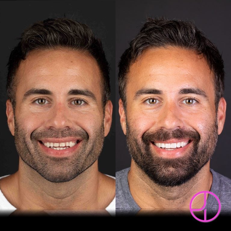 Expertise Dental Smile Gallery