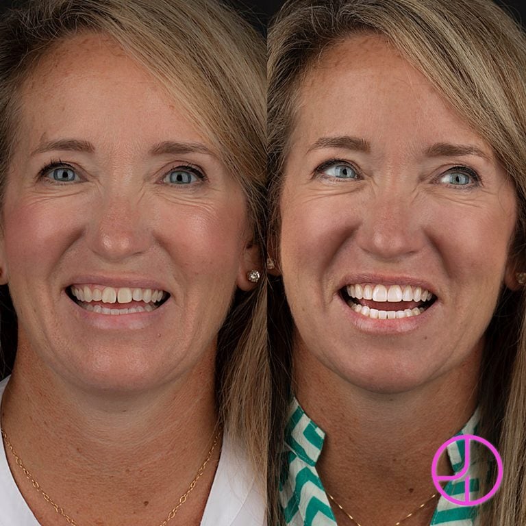 Expertise Dental Smile Gallery