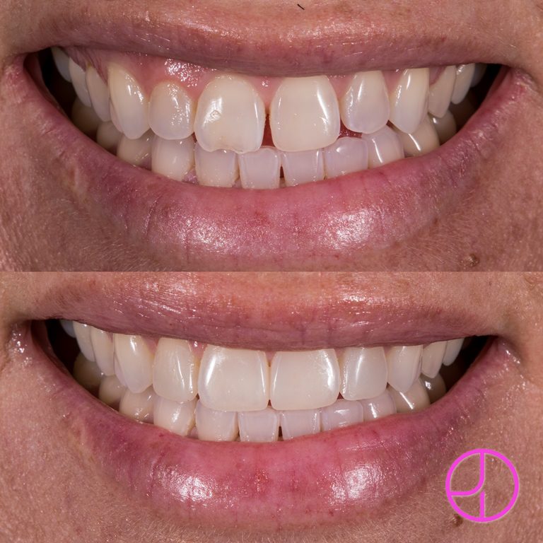 Expertise Dental Smile Gallery
