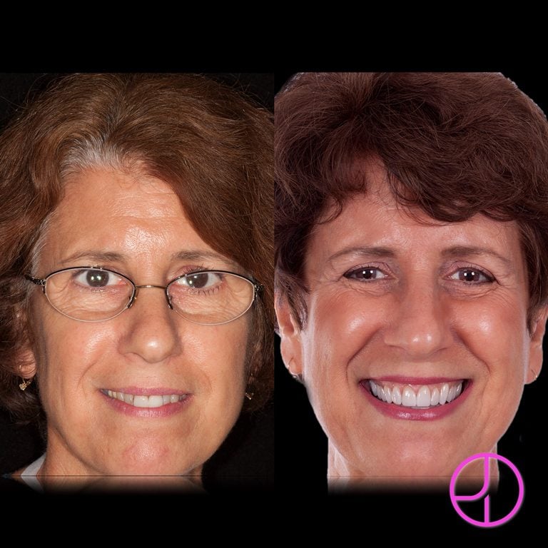 Expertise Dental Smile Gallery