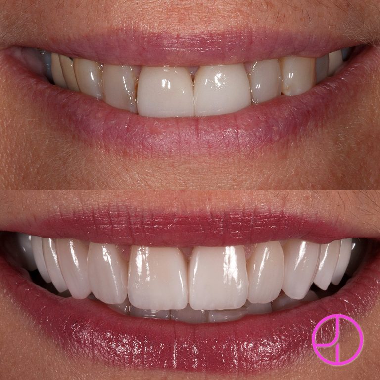 Expertise Dental Smile Gallery