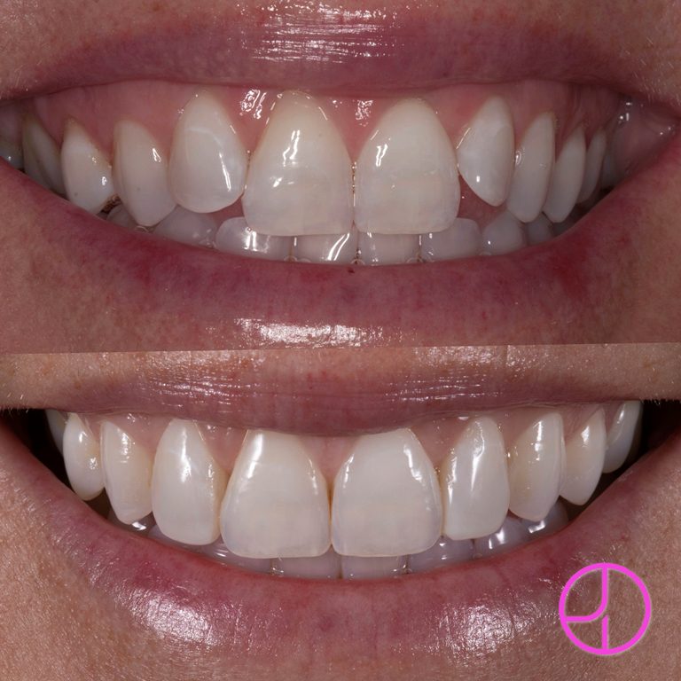 Expertise Dental Smile Gallery