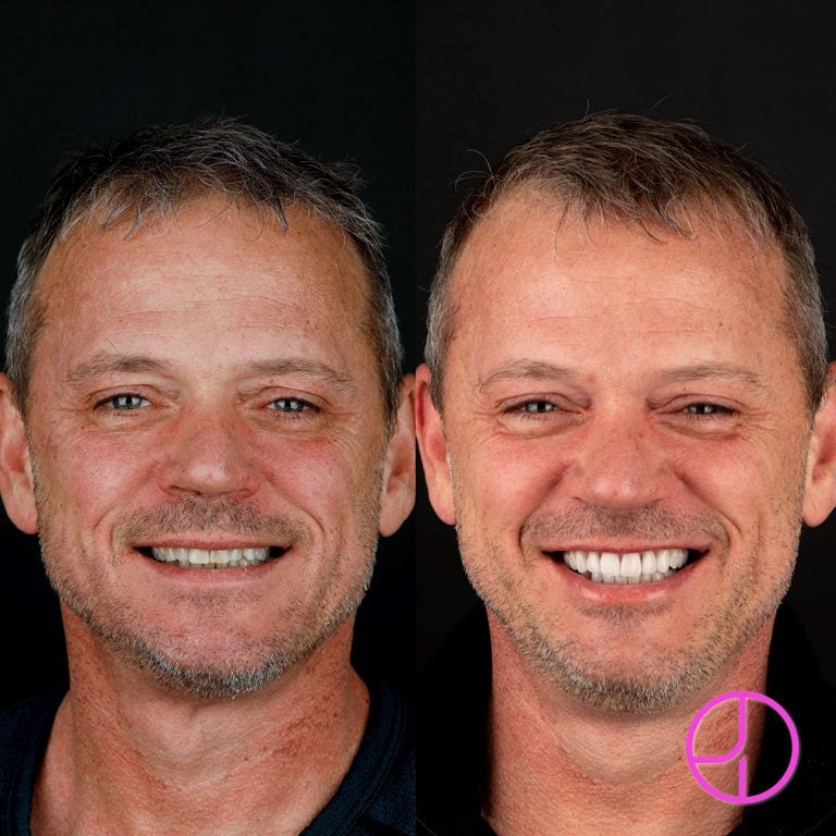 Expertise Dental Smile Gallery