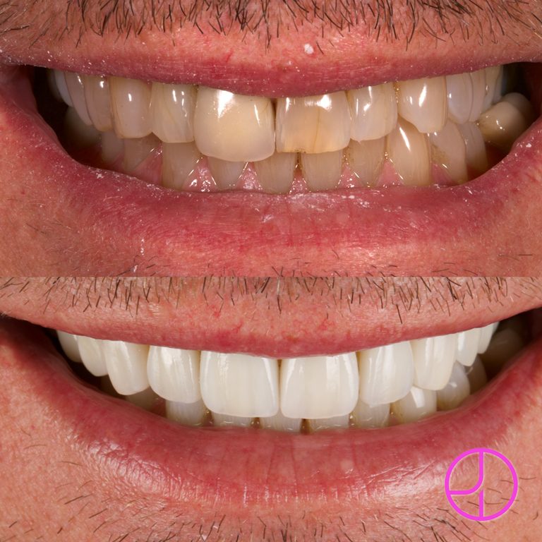 Expertise Dental Smile Gallery