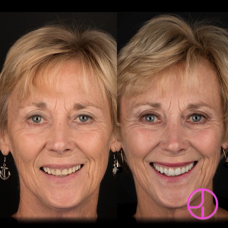 Expertise Dental Smile Gallery