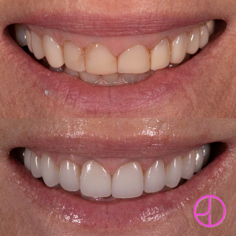 Expertise Dental Smile Gallery
