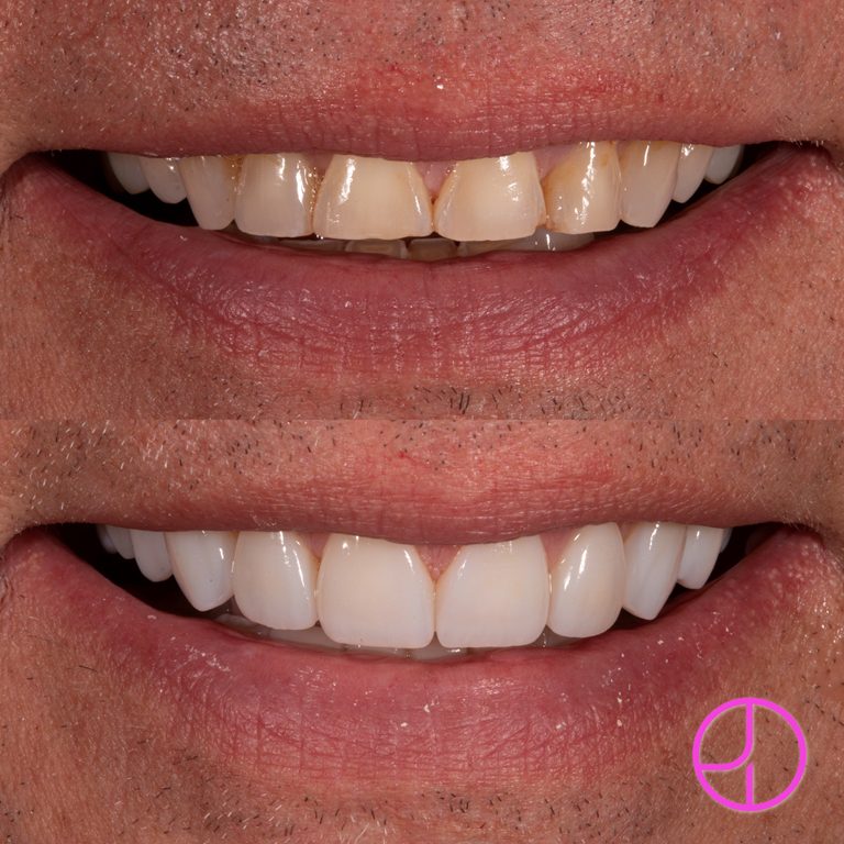 Expertise Dental Smile Gallery