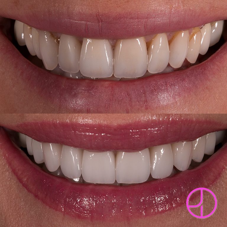 Expertise Dental Smile Gallery