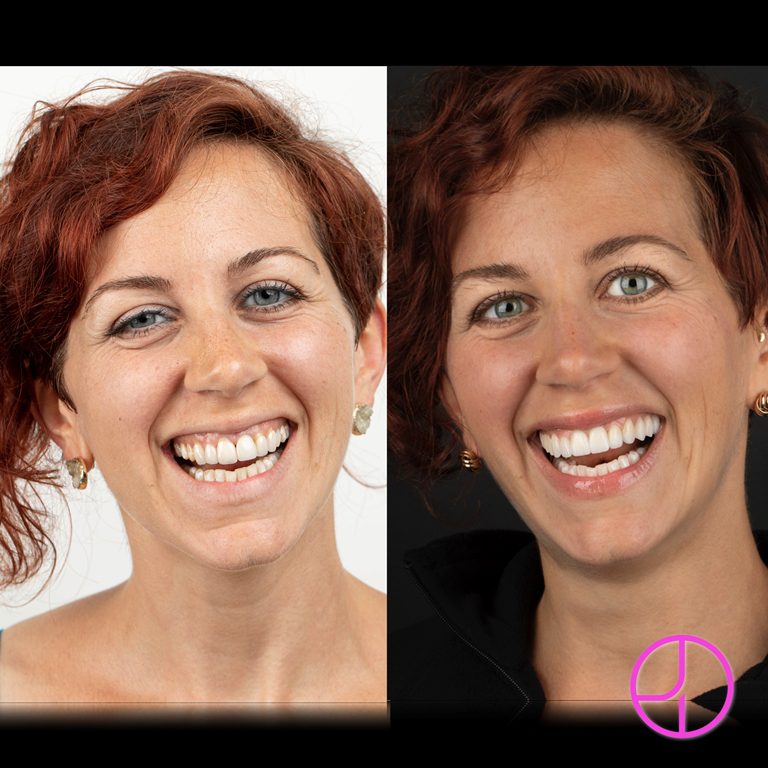 Expertise Dental Smile Gallery