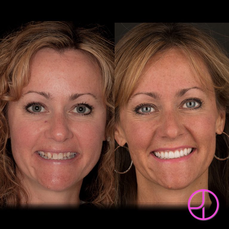 Expertise Dental Smile Gallery