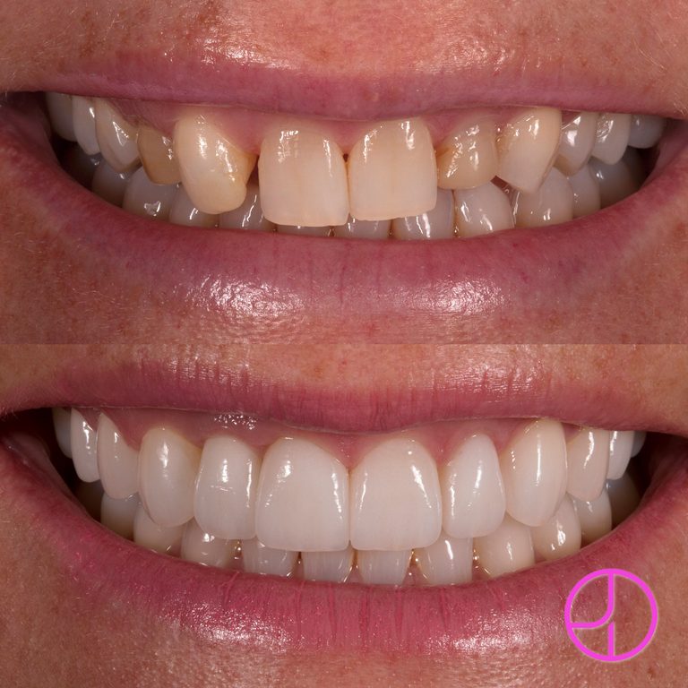 Expertise Dental Smile Gallery