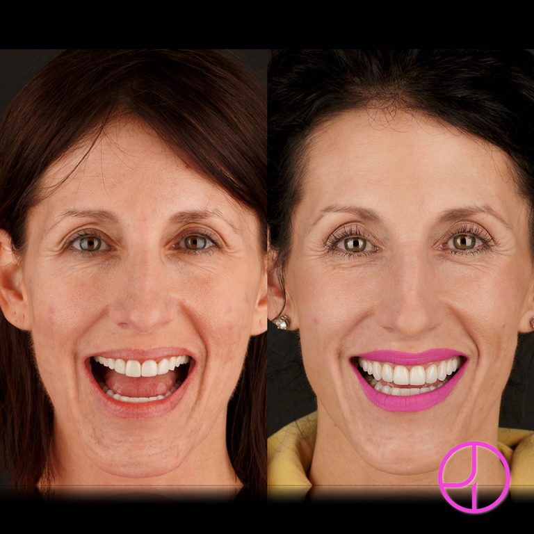 Expertise Dental Smile Gallery