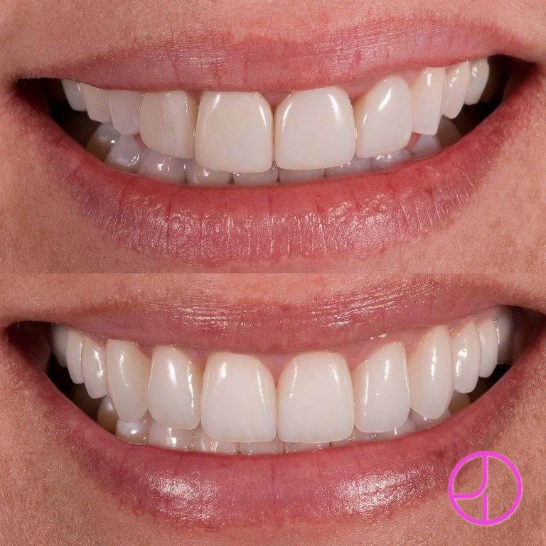 Expertise Dental Smile Gallery