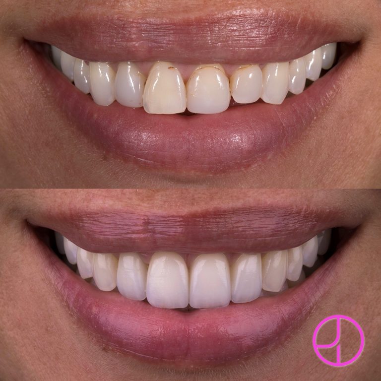 Expertise Dental Smile Gallery