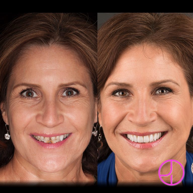 Expertise Dental Smile Gallery