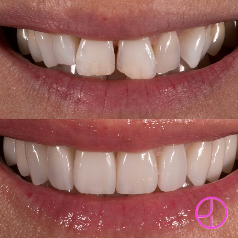 Expertise Dental Smile Gallery