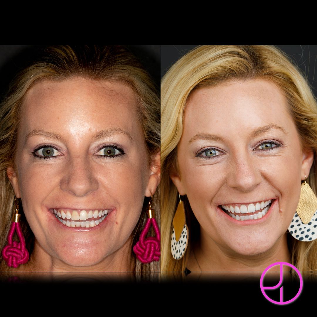 Expertise Dental Smile Gallery