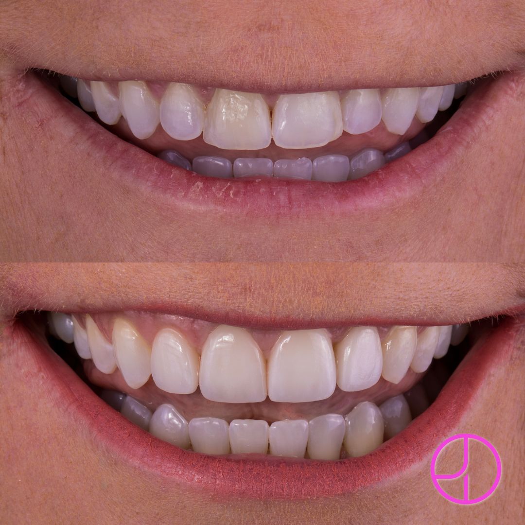 Expertise Dental Smile Gallery