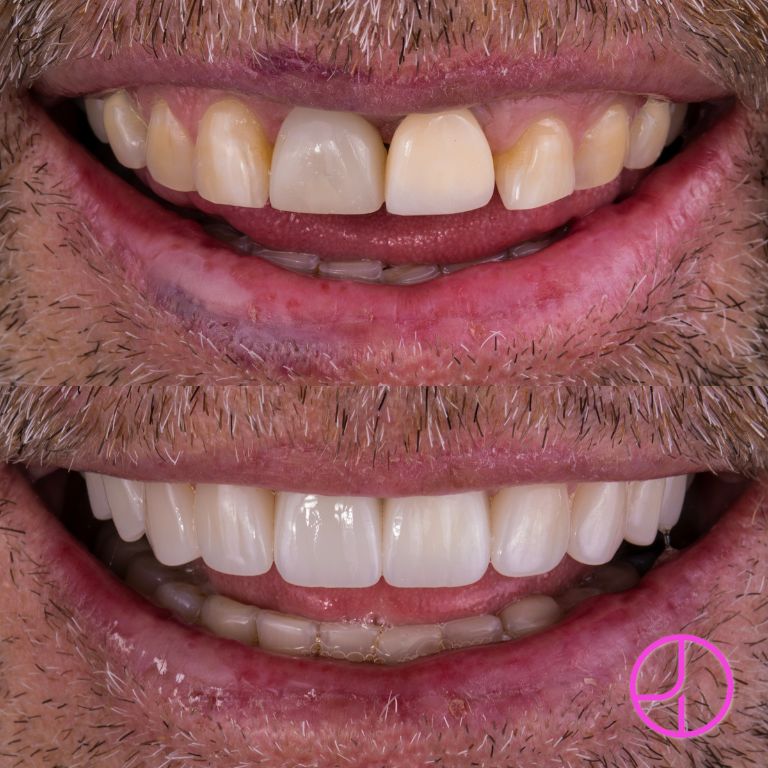 Expertise Dental Smile Gallery