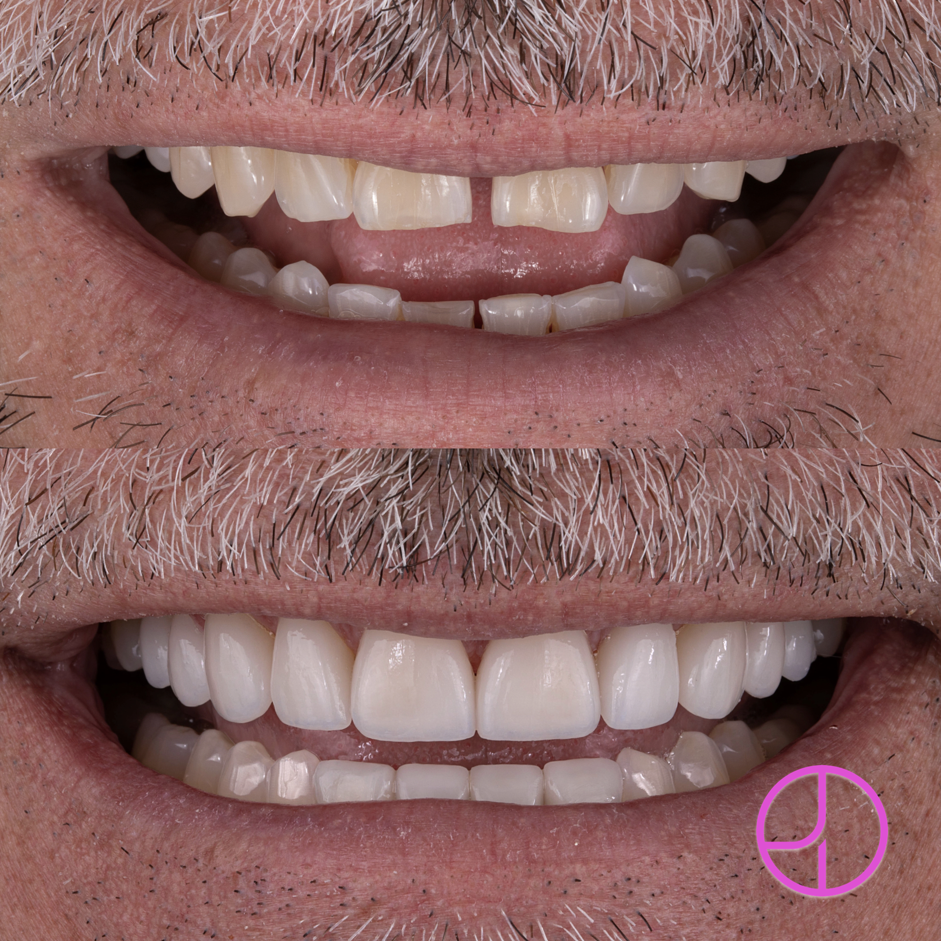 Expertise Dental Smile Gallery
