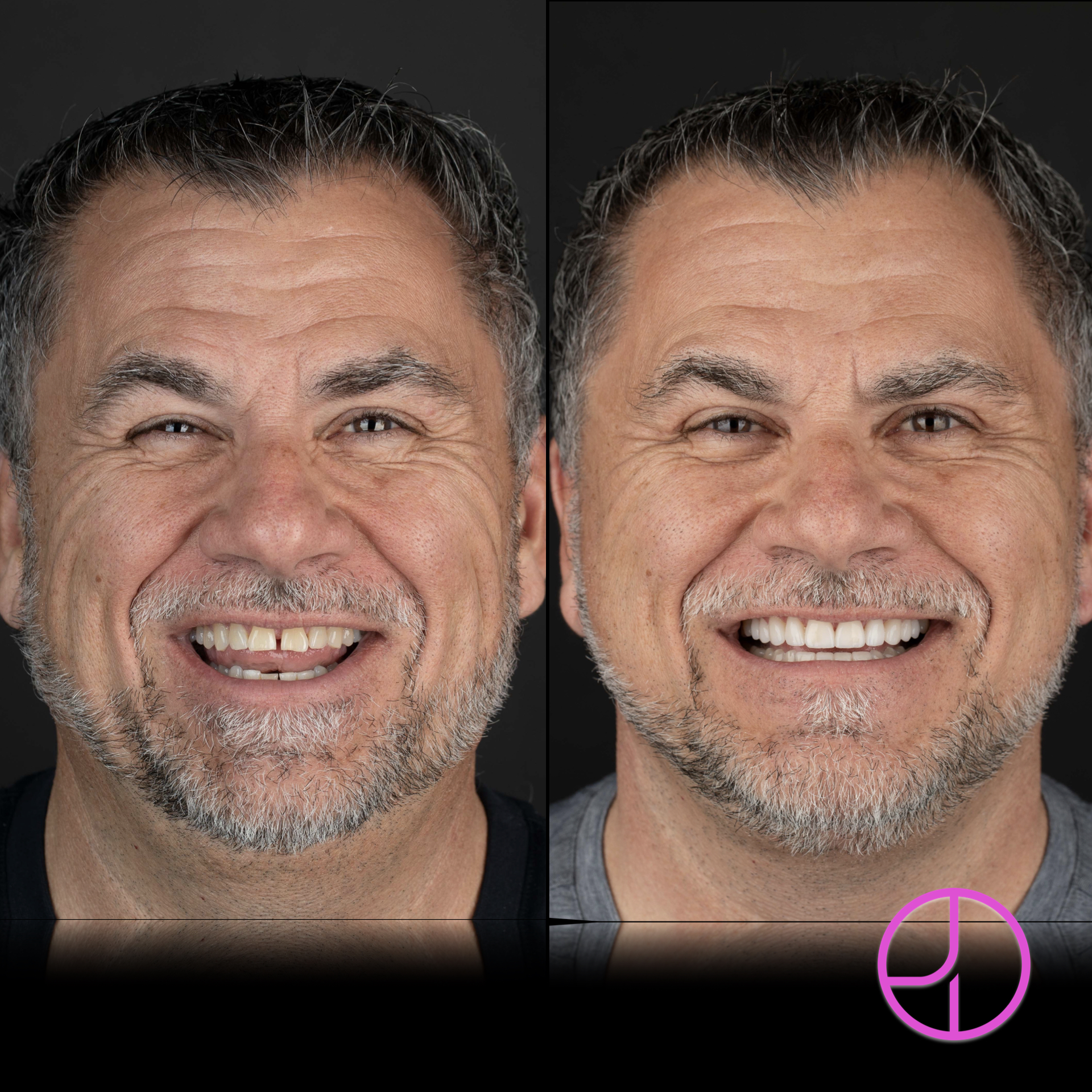 Expertise Dental Smile Gallery