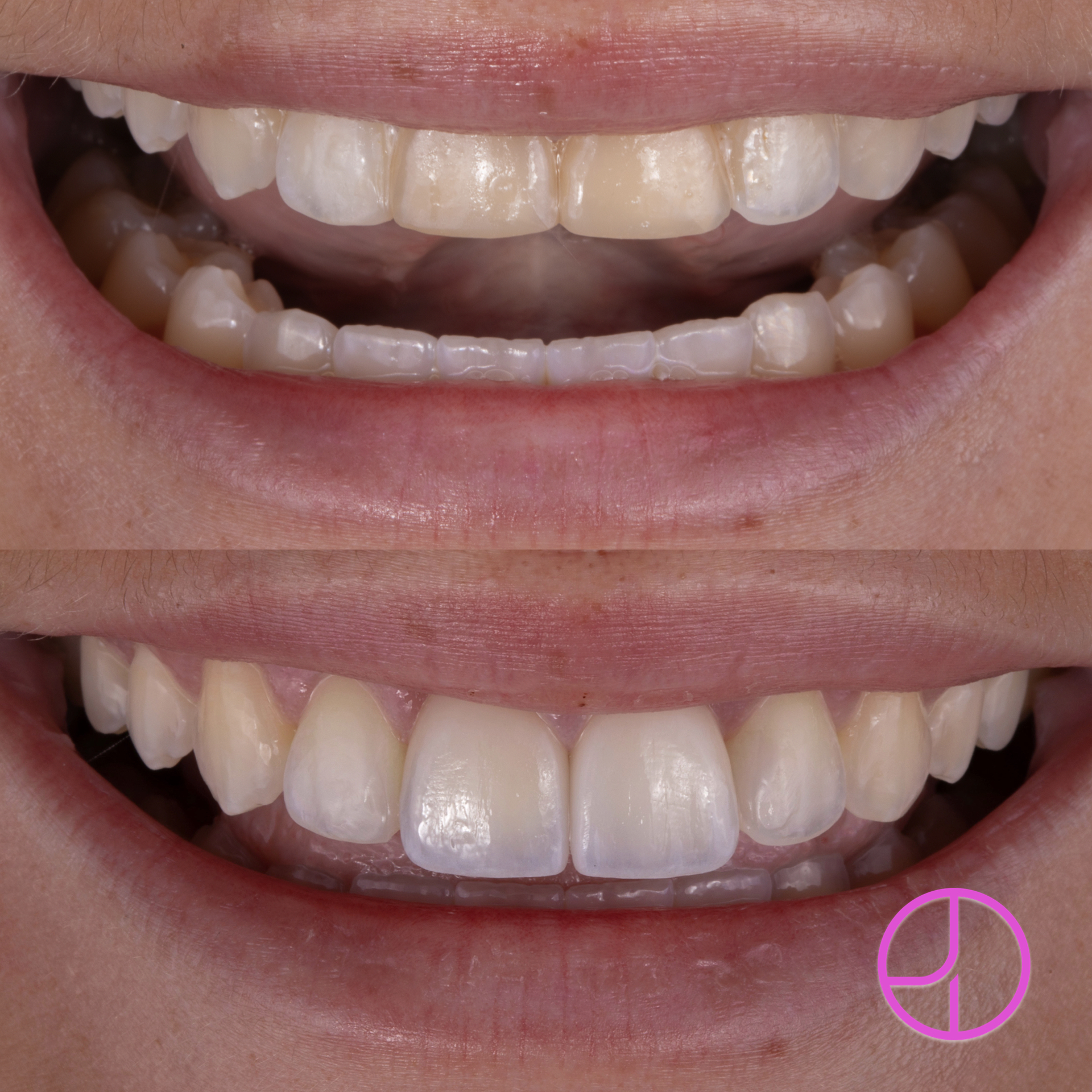 Expertise Dental Smile Gallery