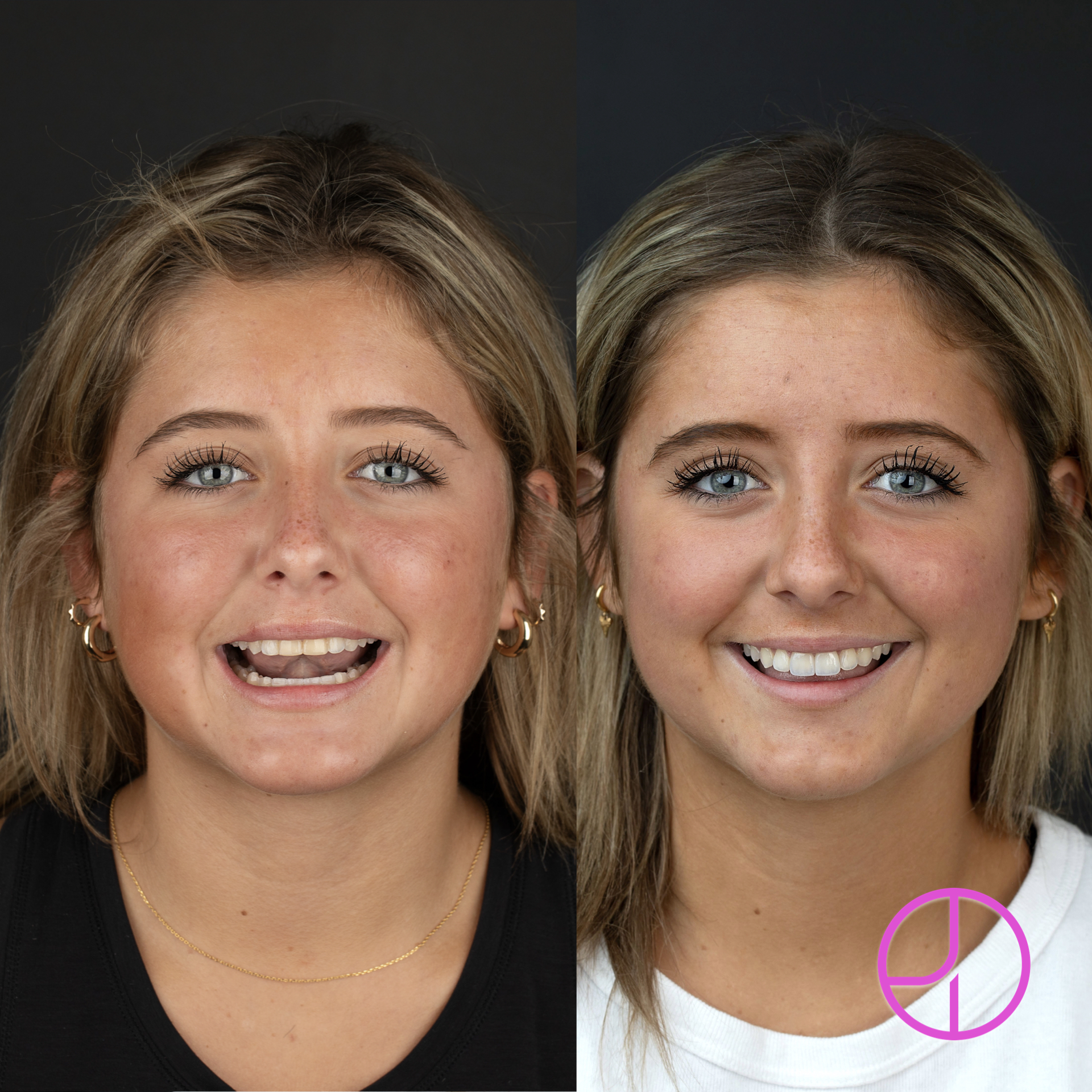 Expertise Dental Smile Gallery