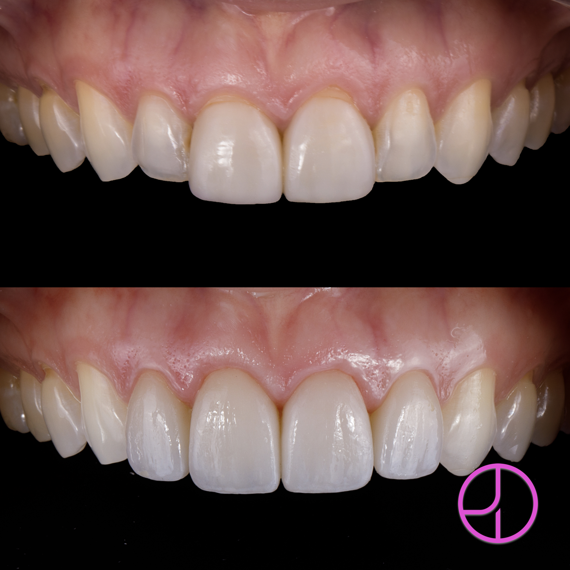 Expertise Dental Smile Gallery
