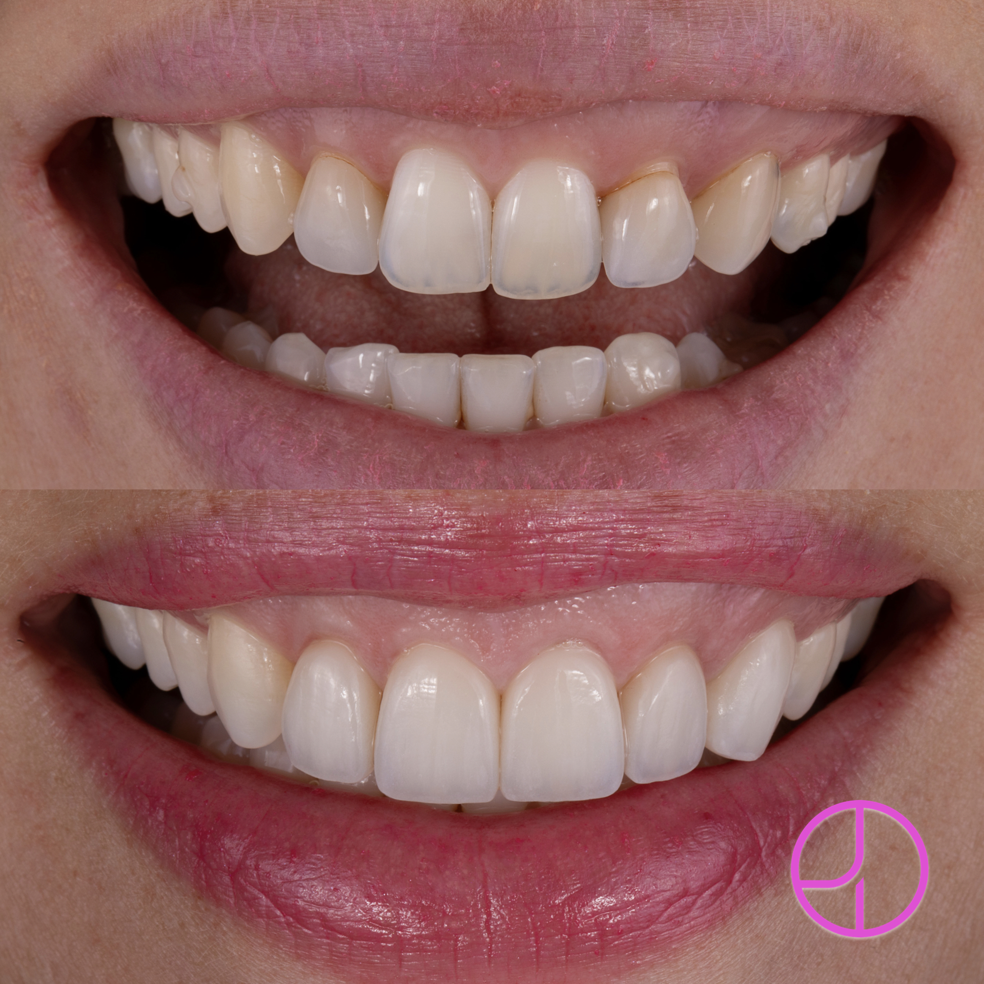 Expertise Dental Smile Gallery
