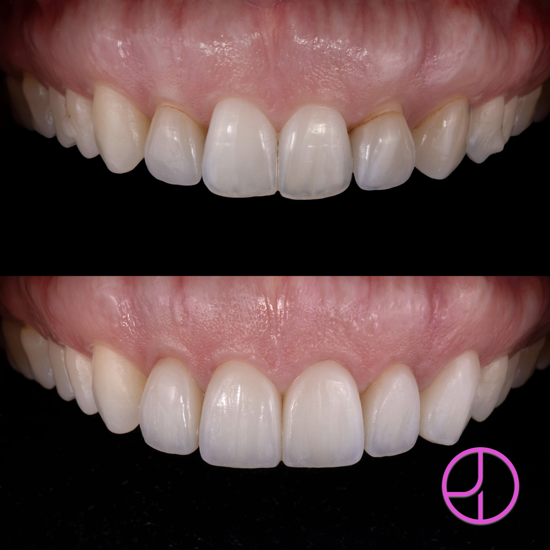 Expertise Dental Smile Gallery