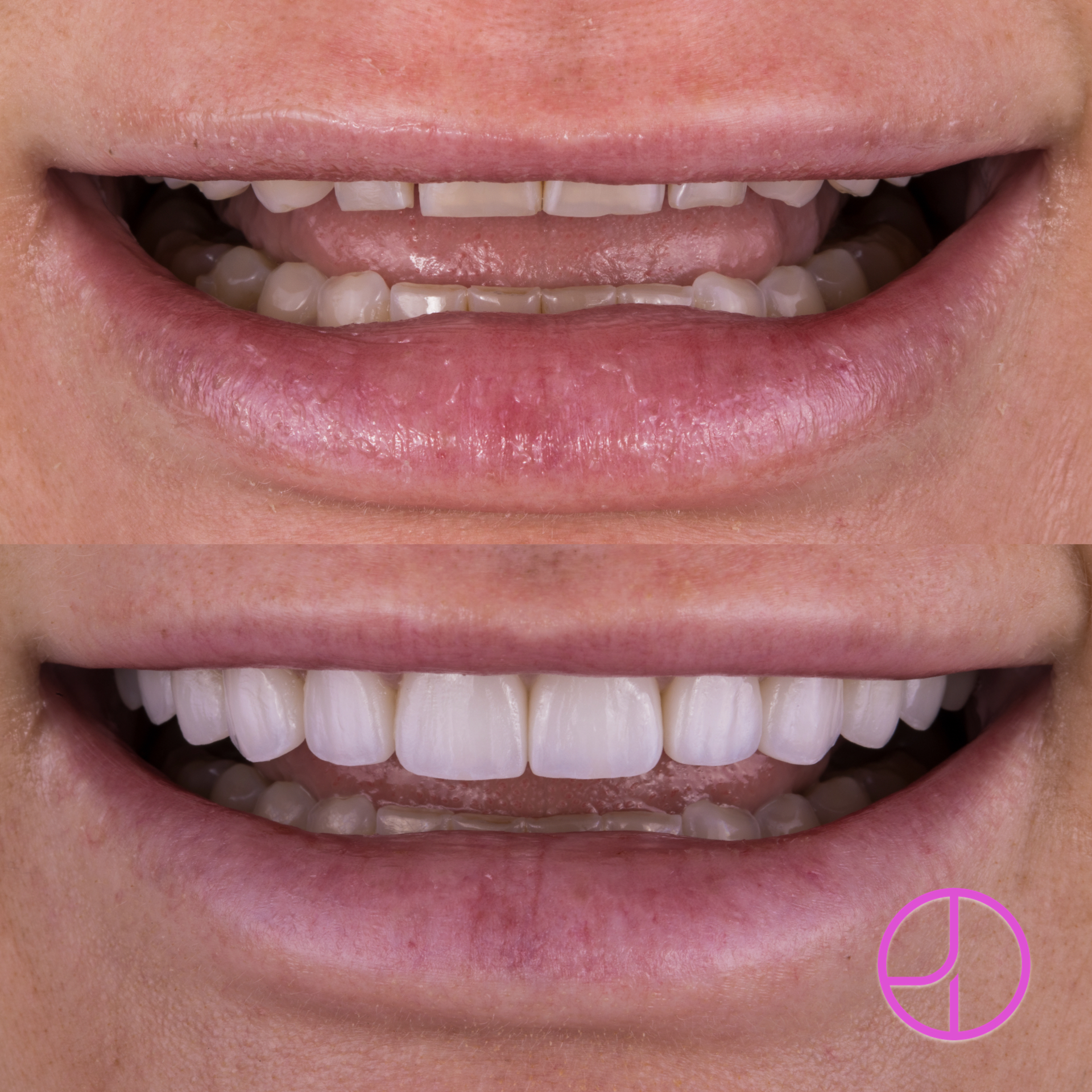 Expertise Dental Smile Gallery