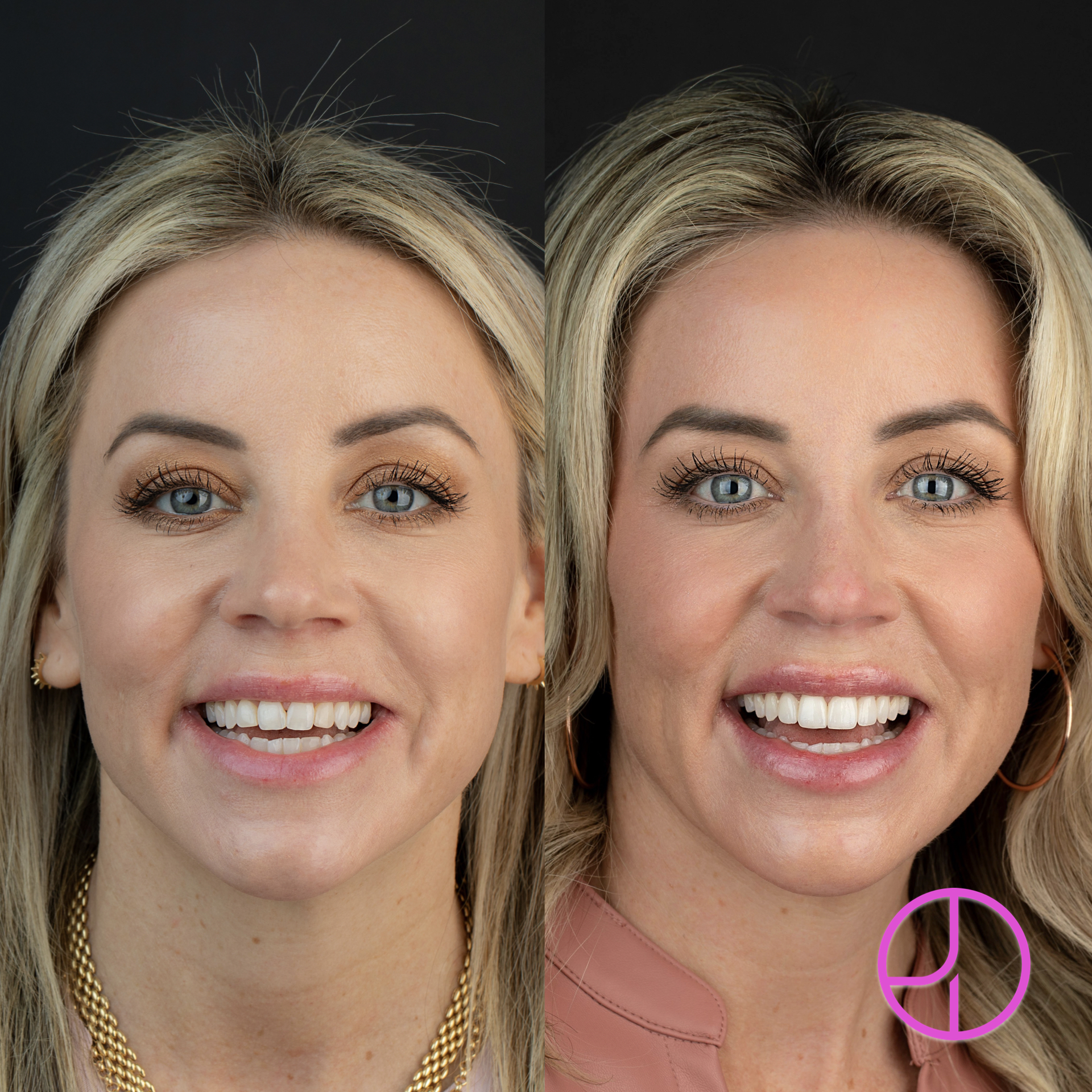 Expertise Dental Smile Gallery