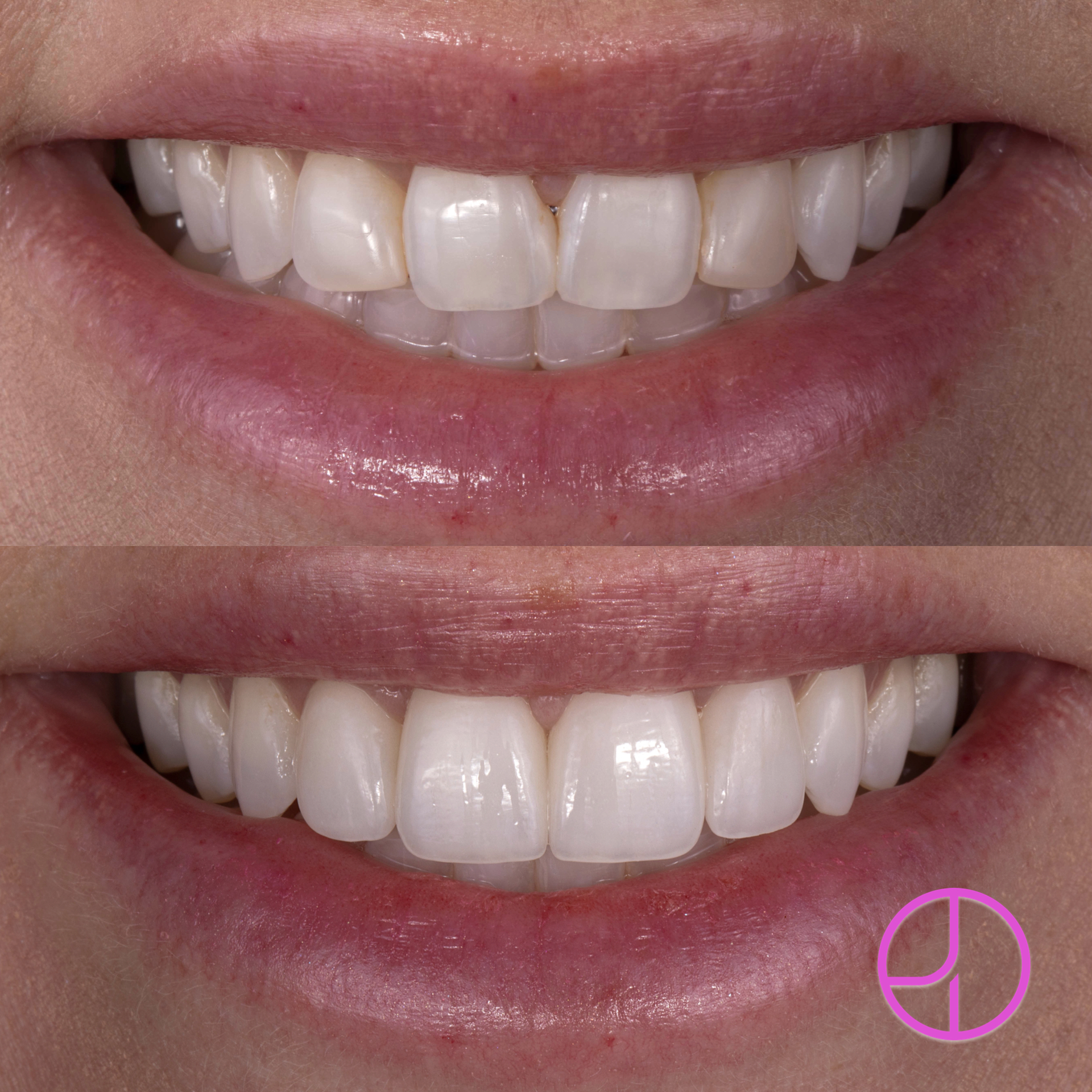 Expertise Dental Smile Gallery