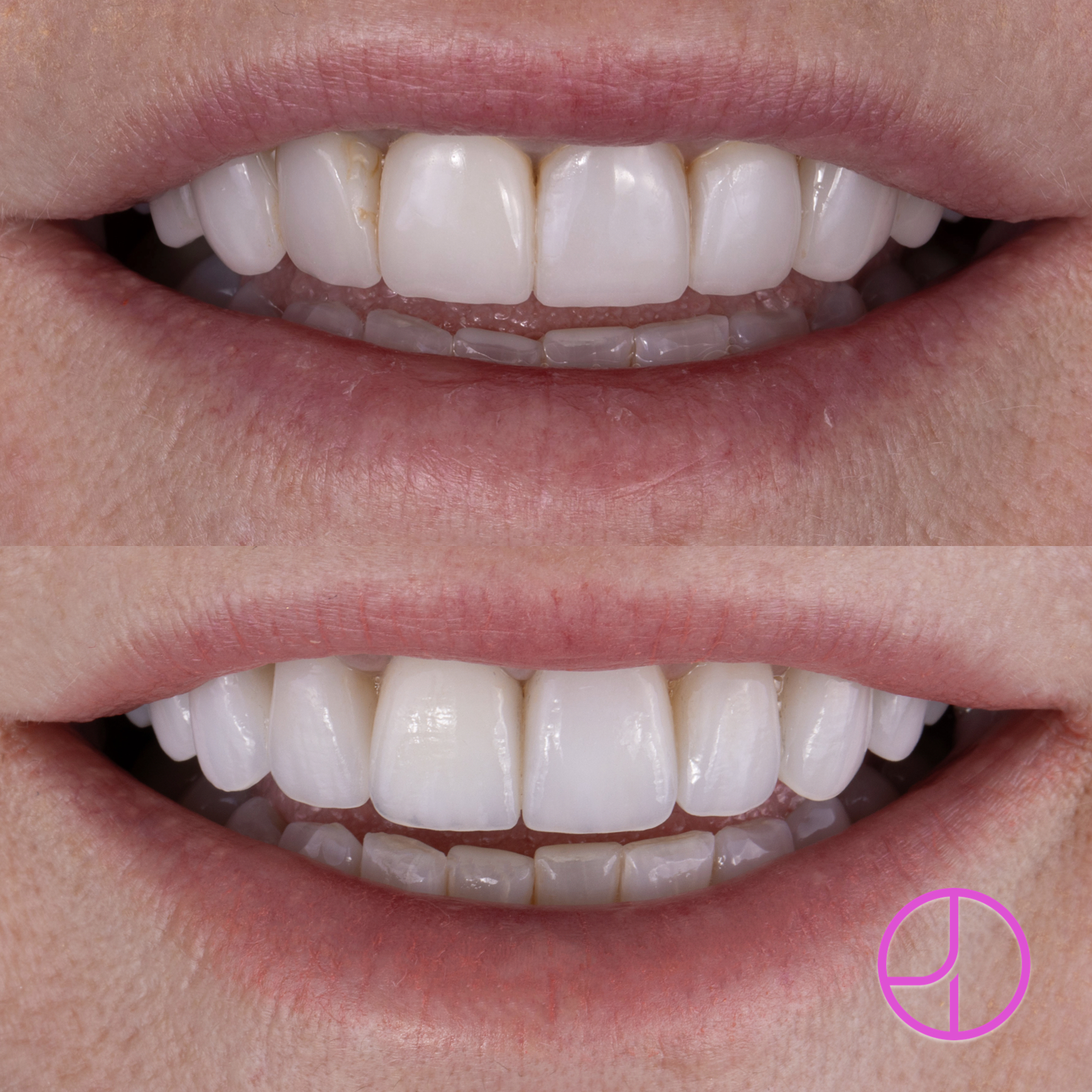 Expertise Dental Smile Gallery