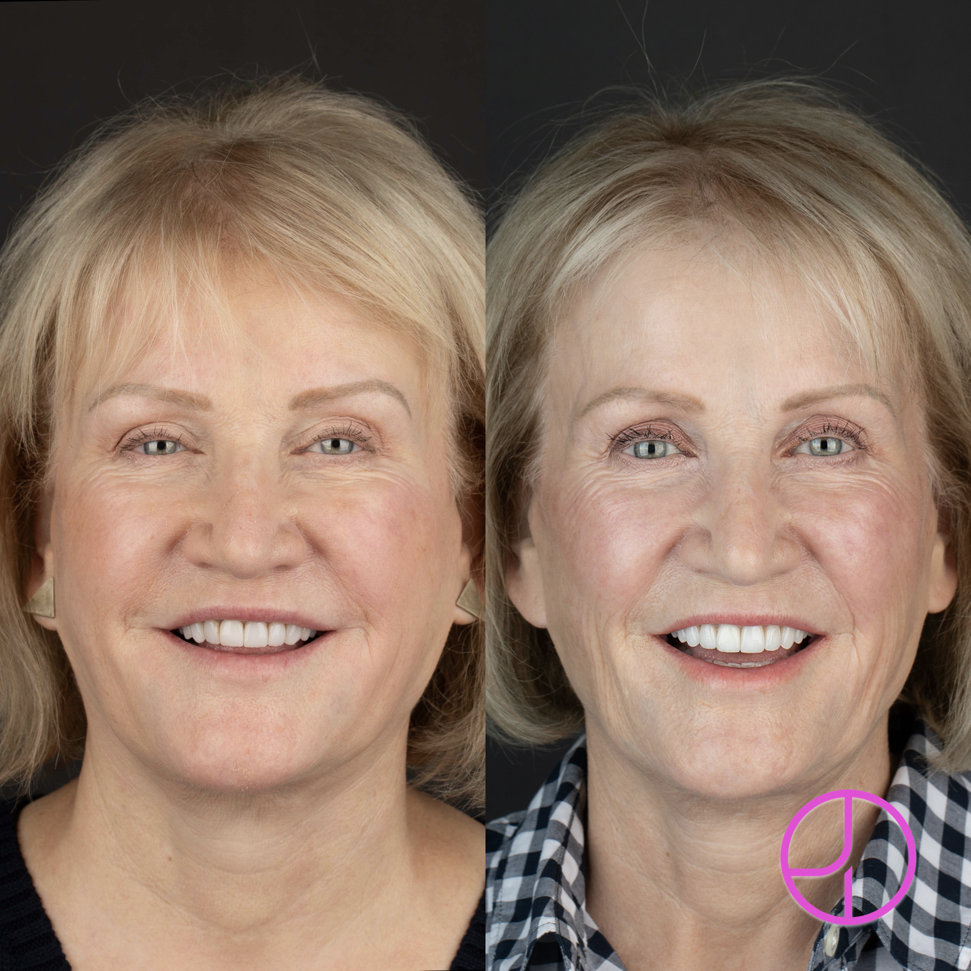 Expertise Dental Smile Gallery