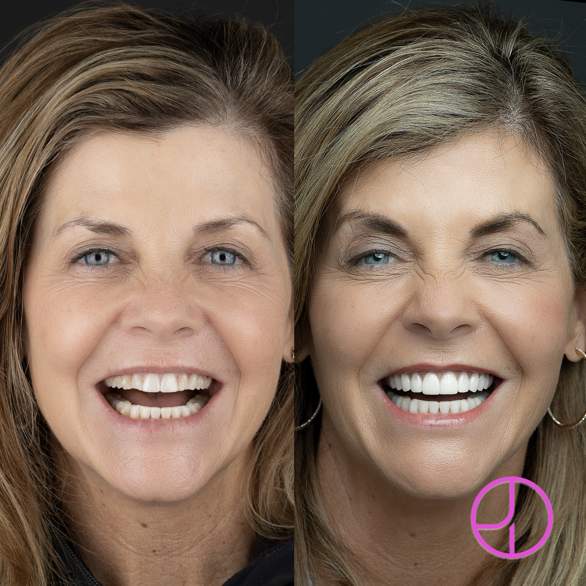 Expertise Dental Smile Gallery
