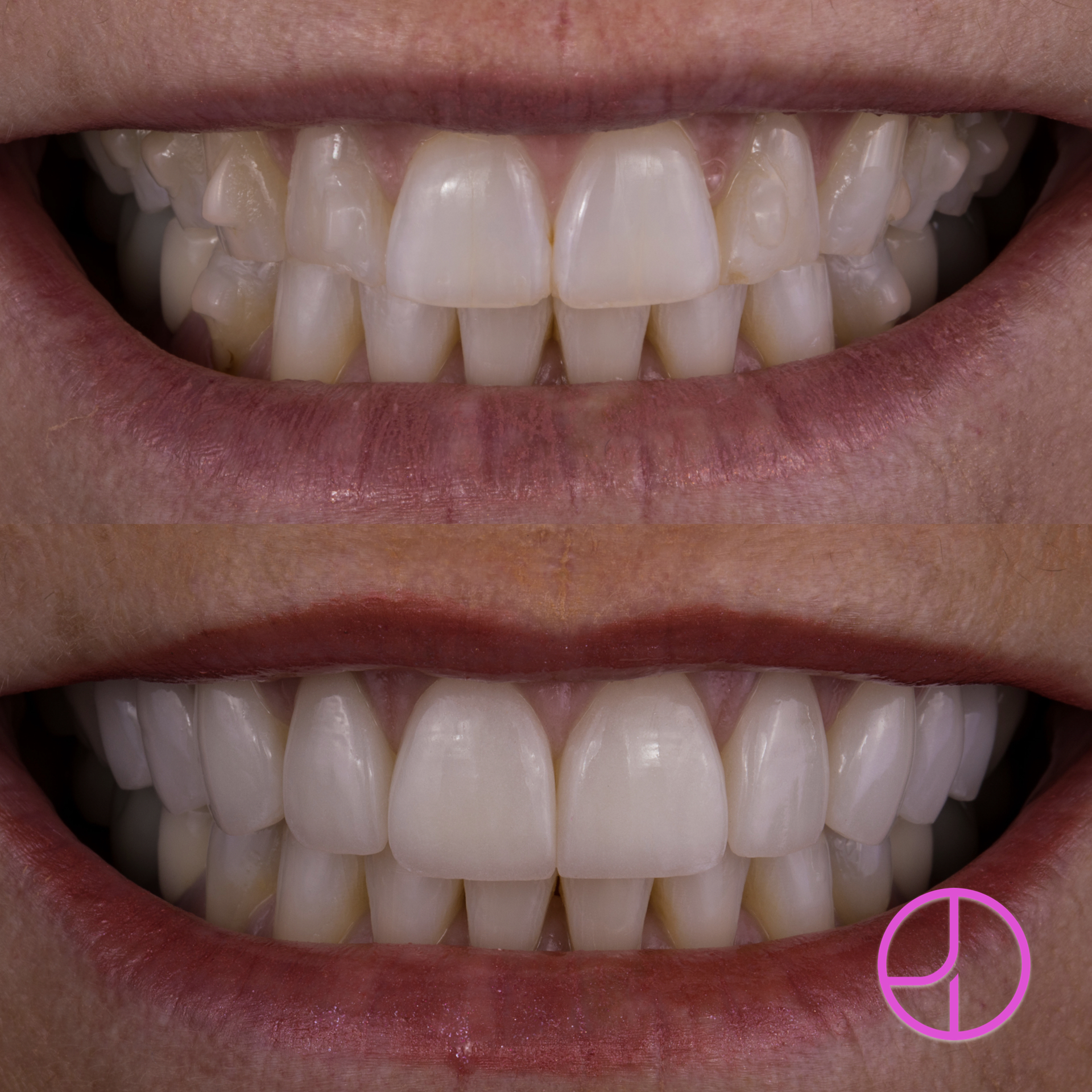 Expertise Dental Smile Gallery
